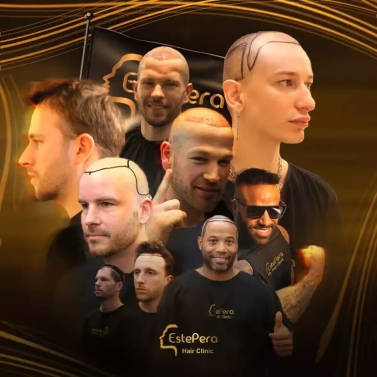 hair transplant in turkey why estepera leads the way in dhi sapphire fue and fue techniques Q7zLWLGe.jpg
