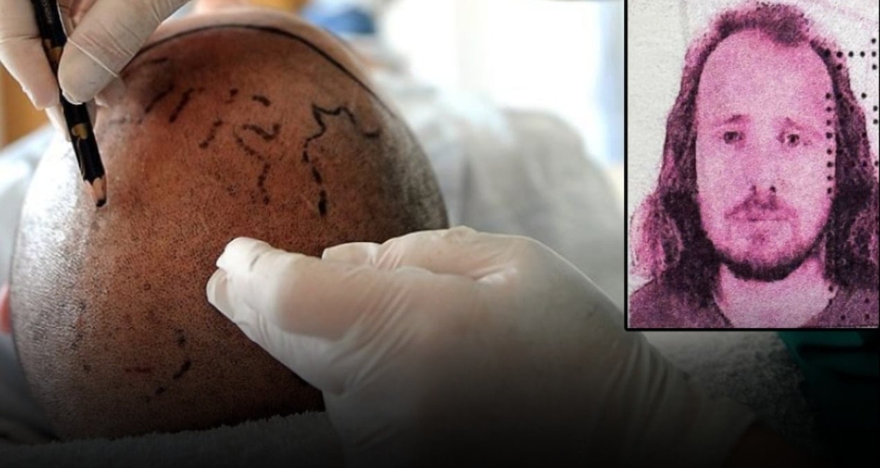 Saç ekimi ve diş tedavisi için Türkiye’ye gelen İngiliz turist hayatını kaybetti