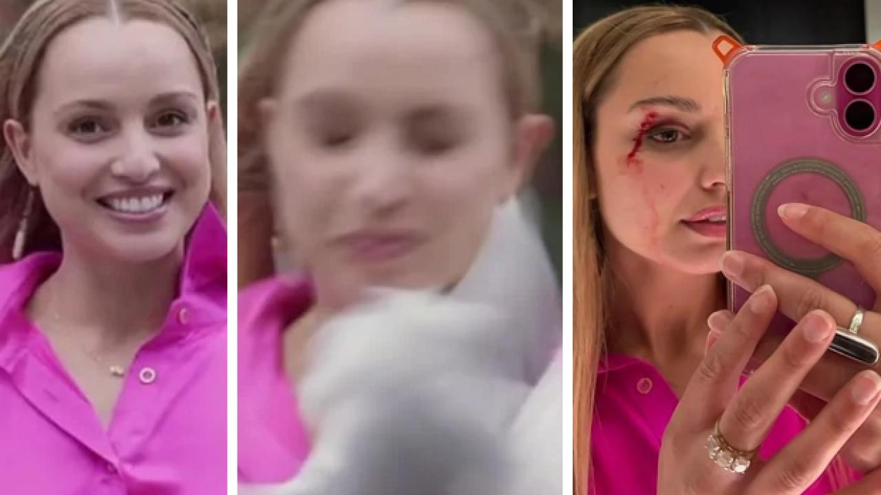 Muhabirin zor anları! Yüzüne kuş çarptı