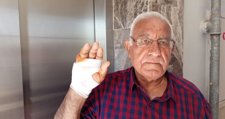 hatayda-akilalmaz-olay-cok-sevdigi-komsusu-parmagini-isirarak-kopardi-k8engeu2
